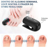 KTS LaserCare – Dispositivo Avançado para Tratamento de Fungos nas Unhas